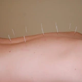 Acupunctuur Sven Steyt