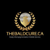 The Bald Cure Vancouver Scalp Micropigmentation Kevin Harper