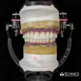 Technics Dental Laboratory Reviews