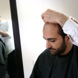 Protesi Capelli Hair Again | Infoltimento Capelli Roma