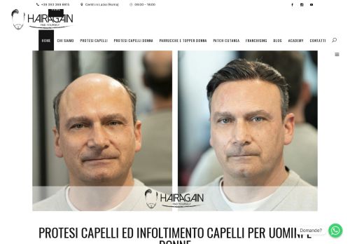 Protesi Capelli Hair Again | Infoltimento Capelli Roma