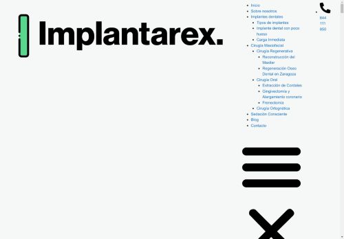 implantarex.com