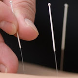 Lotus Acupuncture & Fertility Clinic