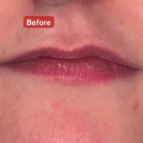 refineaestheticsbyalison.com