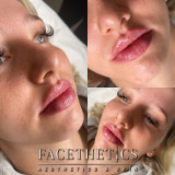 Facethetics Clinic & Training Academy