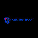 Hair Transplant Paris Reviews